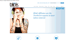 Desktop Screenshot of blinktattooremoval.com